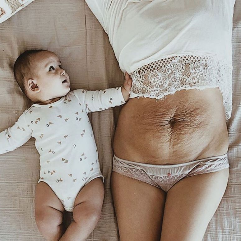 Warum sich der Bauch nach der Geburt langsam verändert